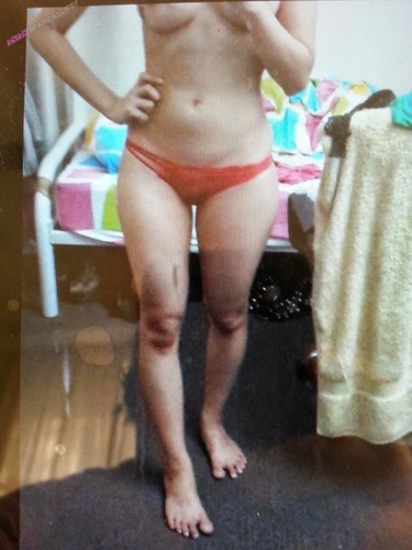 Korean Australia Beautiful Oo Su Ye Mon Leaked Naked Photos